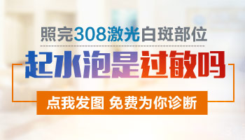 小腿皮肤血管白斑怎么办
